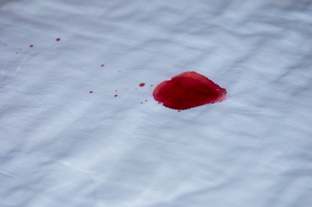 Aan Het eens zijn met te binden Hoe krijg je bloed uit kleding? | Ik woon fijn